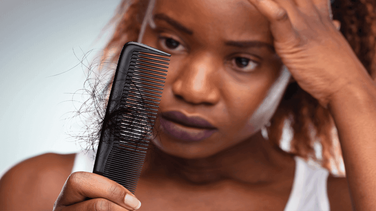 Hair Loss