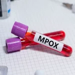 Mpox