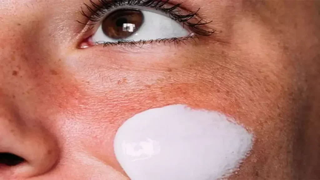 Best Skincare Products for Hyperpigmentation