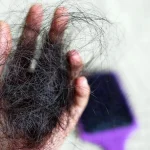 10 Hair Loss Prevention Methods You Should Try
