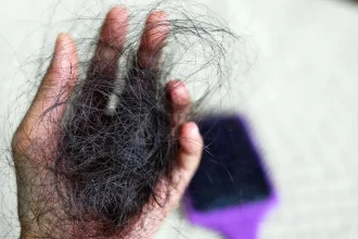 10 Hair Loss Prevention Methods You Should Try