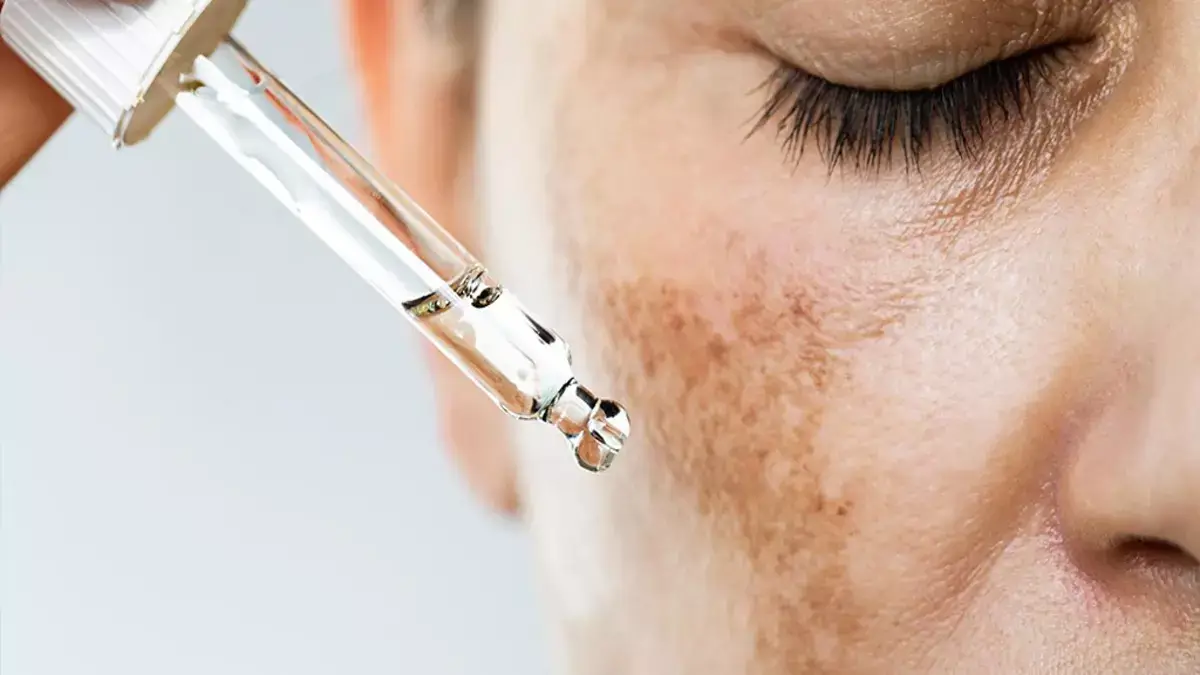 Best Skincare Products for Hyperpigmentation