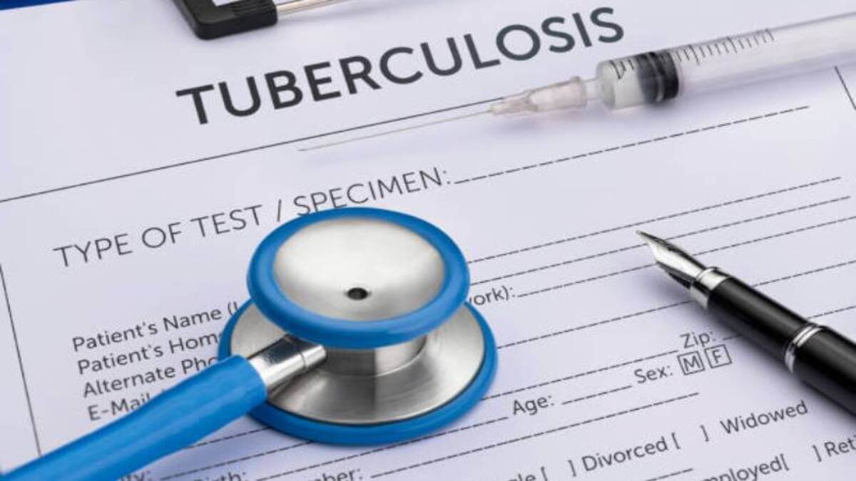 Top Tips on How to Prevent TB: Protect Yourself and Your Loved Ones