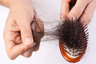 Excessive Hair Loss