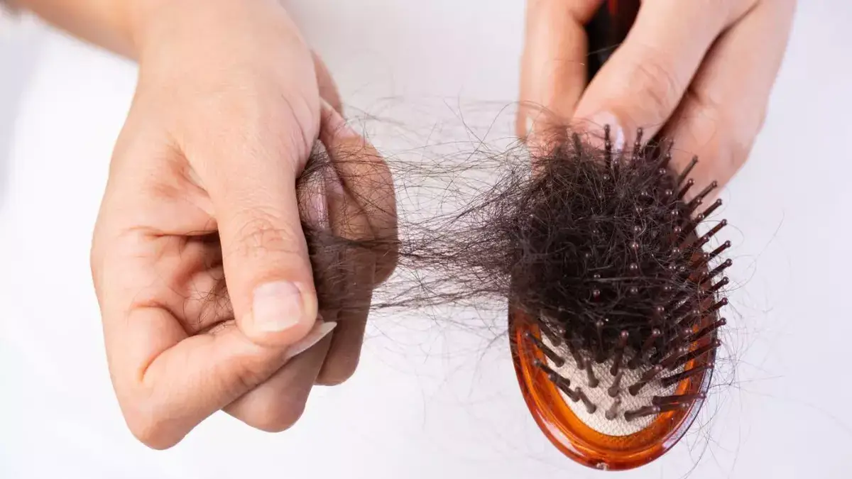 Excessive Hair Loss