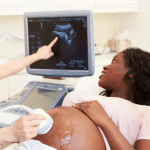 Tshwane City Offers Pregnant Women Early Pregnancy Ultrasound Scans Before 24 Weeks