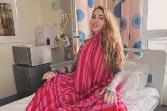 Celebrity News: Jojo Robinson Undergoes Surgery to Reduce ‘Thunder Thighs’