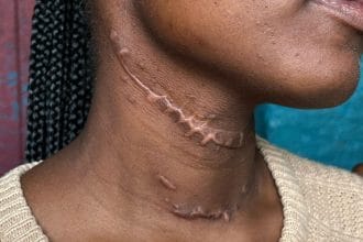 Angelo Woman Survives Brutal Stabbing by Ex-Boyfriend at Home