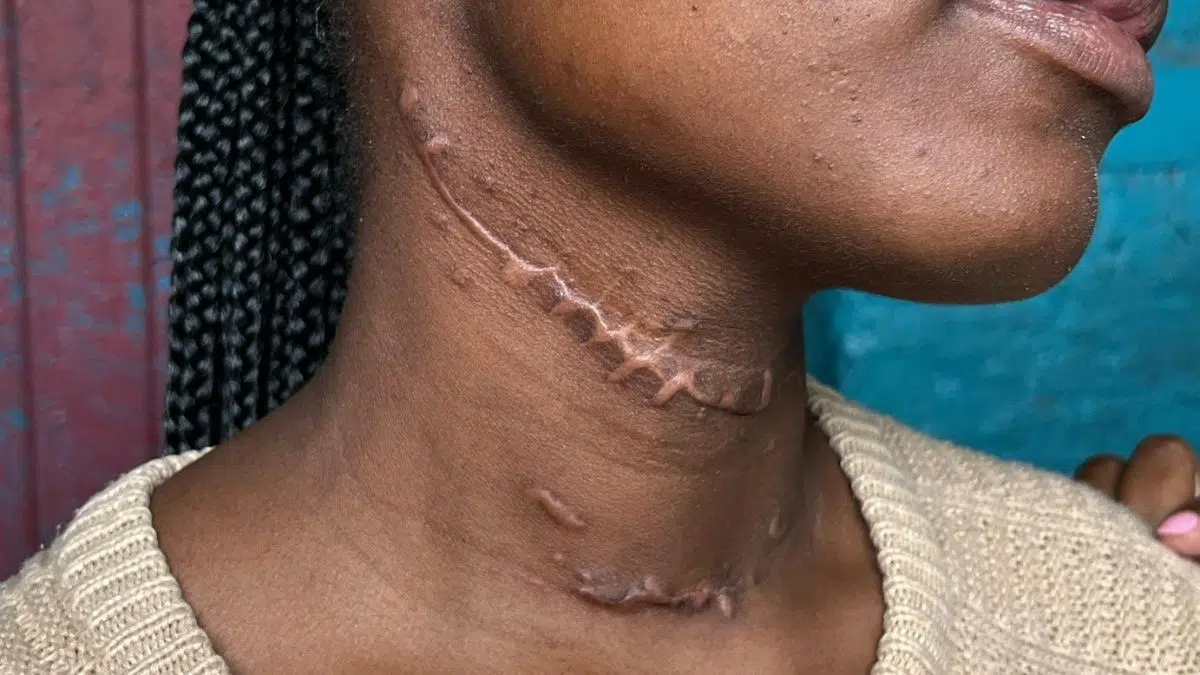 Angelo Woman Survives Brutal Stabbing by Ex-Boyfriend at Home